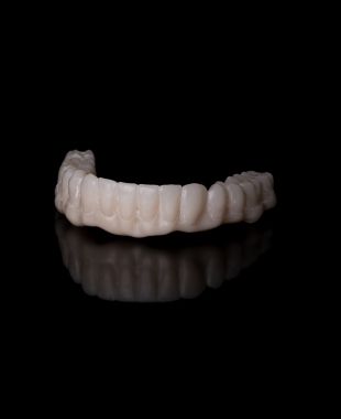 Puente dental cerámico de alta estética fabricado en laboratorio – Juiz Dental