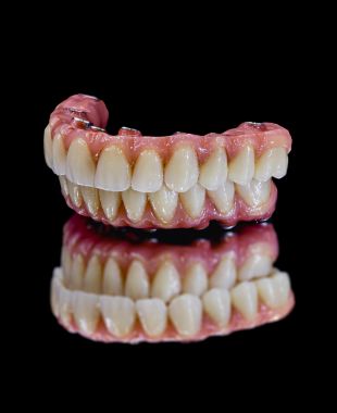 Sobredentadura estética con dientes estratificados – Juiz Dental