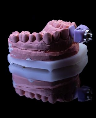 Modelo dental protésico con pilar de fresado CAD/CAM – Juiz Dental