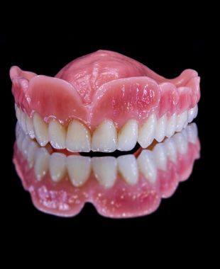 Prótesis completa removible con encía caracterizada – Juiz Dental